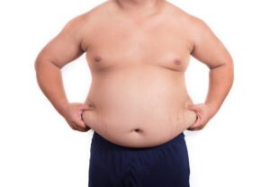 Read more about the article Tummy Tuck Surgery in Gurugram – Get a Flatter, Firmer Abdomen