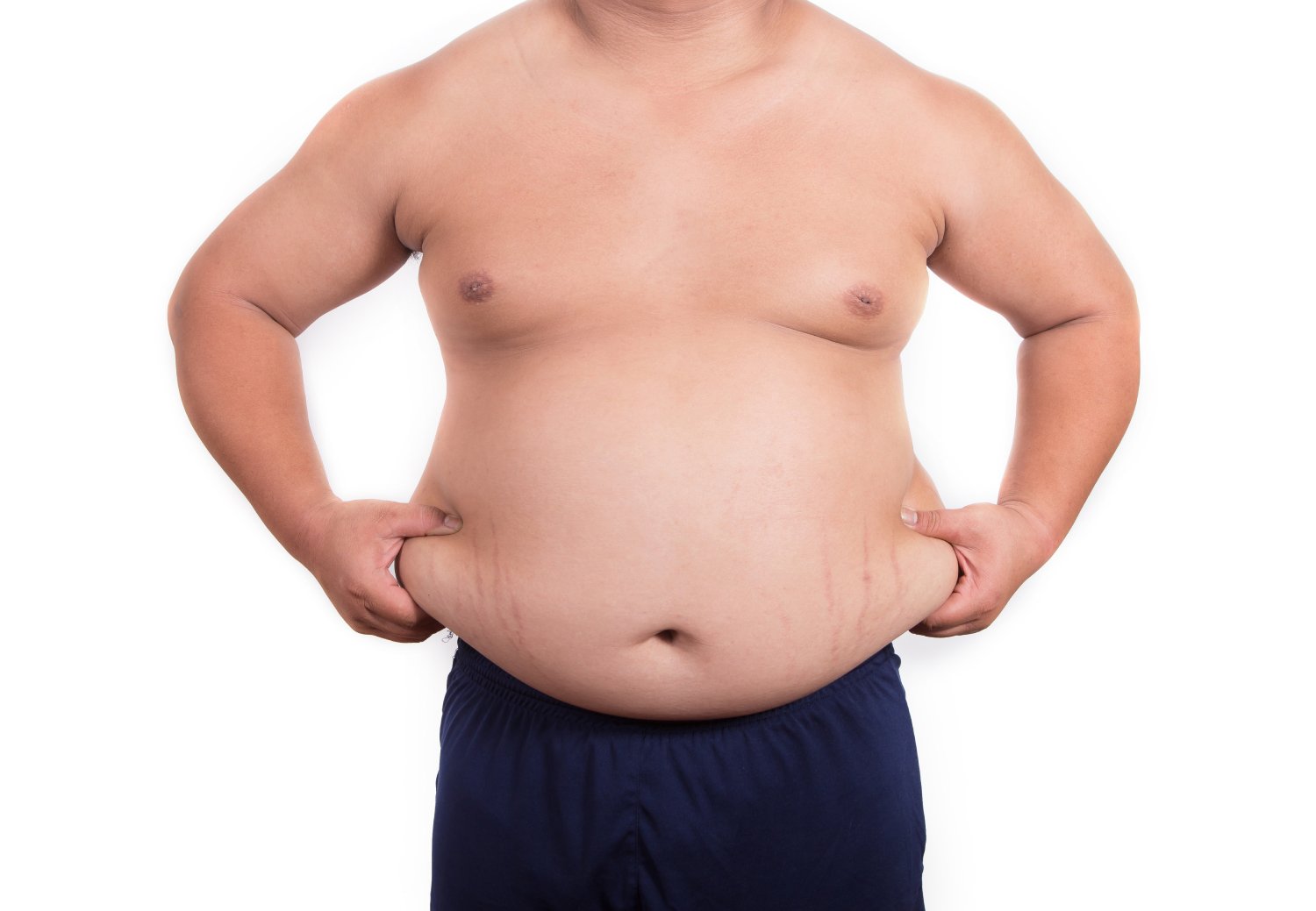 Read more about the article Tummy Tuck Surgery in Gurugram – Get a Flatter, Firmer Abdomen