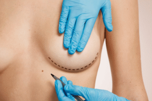 Breast Augmentation Surgery Gurgaon How Much Does Breast Augmentation Cost in Gurgaon