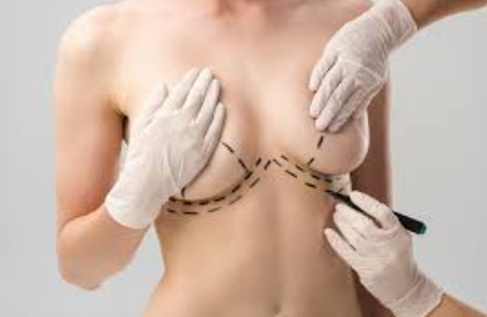 Breast reconstruction surgery