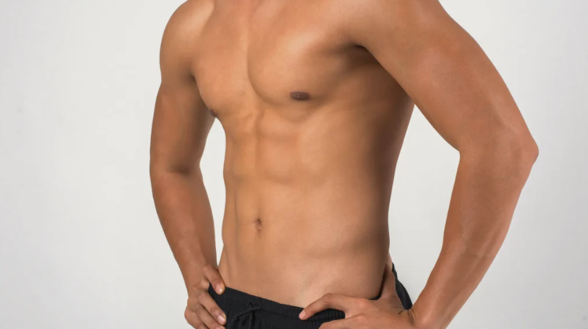 Gynecomastia