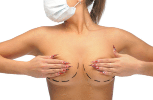 Breast Reduction