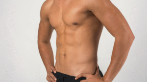 Gynecomastia