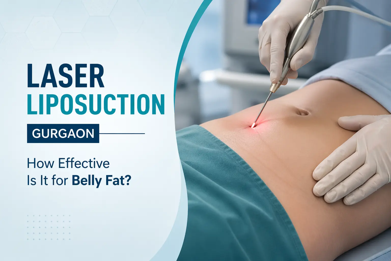 Laser Liposuction Surgery Gurgaon How Effective Is It for Belly Fat
