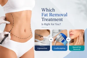 Fat Removal Surgery Gurgaon Liposuction vs CoolSculpting vs Buccal Fat Removal, Which Is Right for You