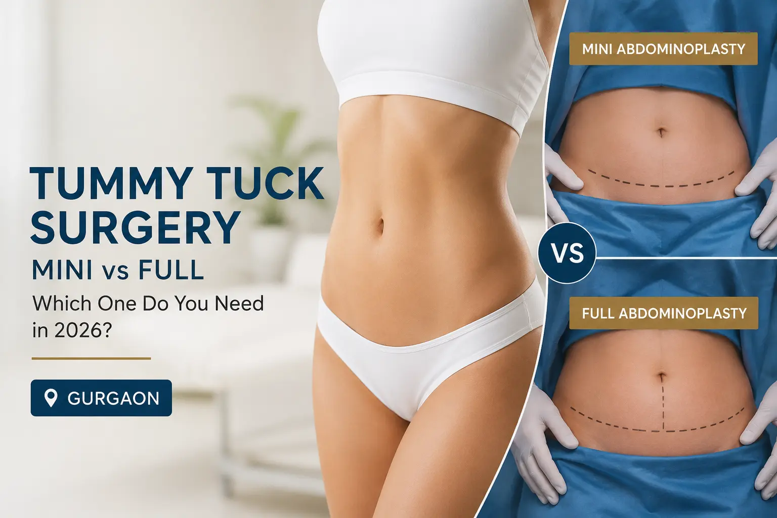 Tummy Tuck Surgery Gurgaon: Mini vs Full Abdominoplasty, Which One Do You Need in 2026?