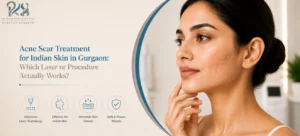 Acne Scar Treatment for Indian Skin in Gurgaon
