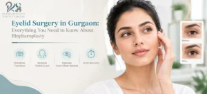 Eyelid Surgery in Gurgaon